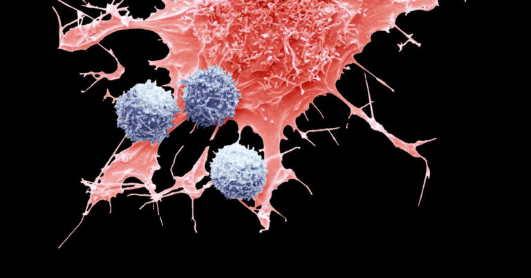 CAR-T, Lifesaving Cancer Treatment, May Sometimes Cause Cancer, FDA Says CAR-T, Lifesaving Cancer Treatment, May Sometimes Cause Cancer, FDA Says