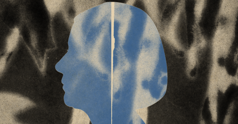 What Is Mild Cognitive Impairment, and How is it Diagnosed? What Is Mild Cognitive Impairment, and How is it Diagnosed?