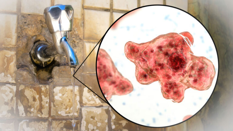 Don’t use unsterilized tap water to rinse your sinuses. It may carry brain-eating amoebas A single silver tap protrudes from a crumbling beige tiled wall. There is a stream of water running from the tap. A circular inset with a triangle pointing to the water has an illustration of one pink blobby amoeba with at least five knobby protrusions. Part of another pink amoeba is visible in the left side of the circle.
