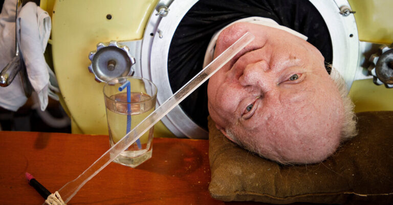 Paul Alexander, Polio Survivor Who Lived in Iron Lung for 70 Years, Dies age 78 Paul Alexander, Polio Survivor Who Lived in Iron Lung for 70 Years, Dies age 78
