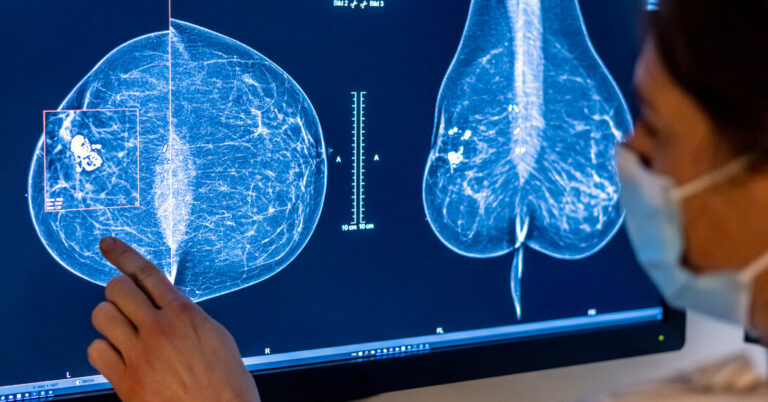 Are AI Mammograms Worth the Cost? Are AI Mammograms Worth the Cost?