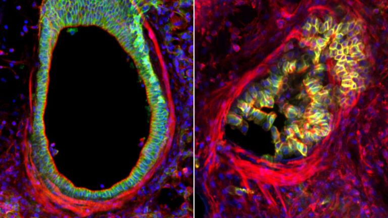 Chronic asthma could be caused by cell overcrowding in the airways Two side-by-side images of a mouse