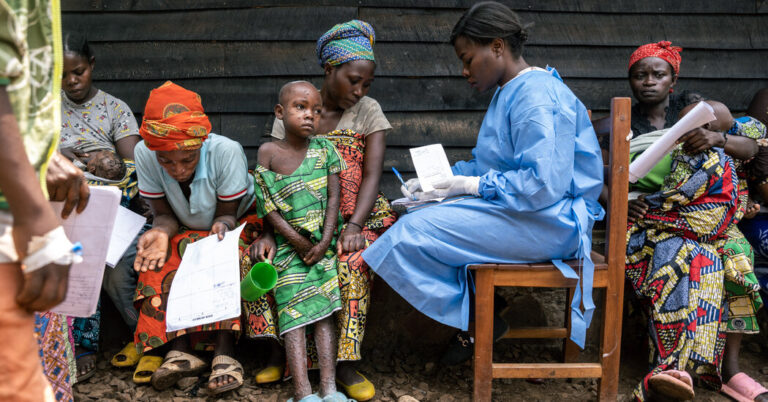 Battling Mpox in the Outbreak’s Epicenter in Congo Battling Mpox in the Outbreak’s Epicenter in Congo