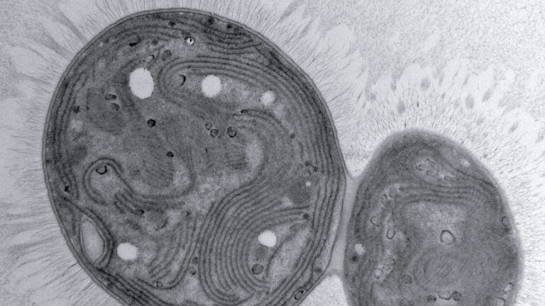 Meet Chonkus, a mutant microbe that could help fight climate change A microscopy image of the Chonkus cyanobacterium.