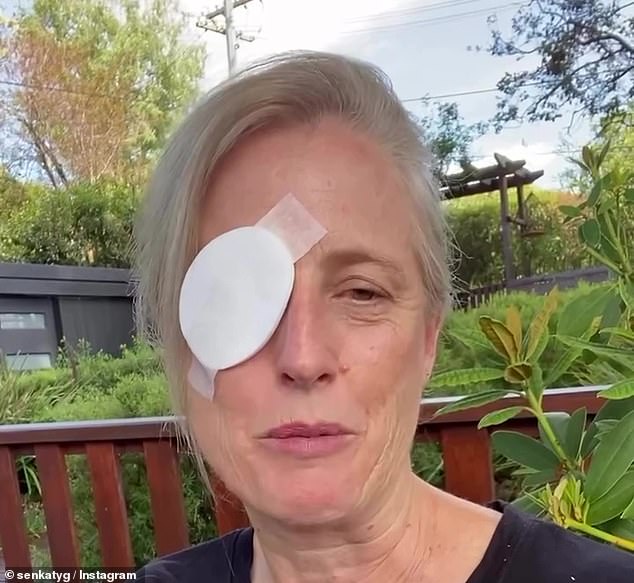 Minister sports an eye patch after shocking injury in her backyard Katy Gallagher (pictured) was sporting an oval-shaped bandage on Saturday