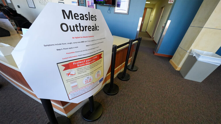 The U.S. measles outbreak shows no signs of slowing A large white sign outside a hospital corridor proclaims in large black letters, Measles Outbreak. The sign gives symptoms of the disease and has a graphic with information about how to protect children with measles vaccines. A second child in Texas recently died from measles.