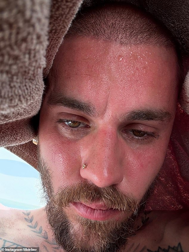 Justin Bieber shares sweaty ‘detox’ selfie amid fan concern over his wellbeing Justin Bieber sparked fan concern once again with another cryptic Instagram post