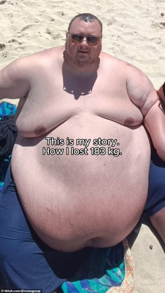 Dawid Lombard before he lost weight